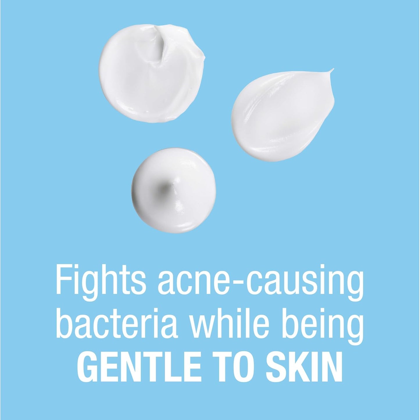 On-The-Spot Acne Spot Treatment Cream with 2.5% Benzoyl Peroxide, Gentle Face Blemish Medicine for Acne-Prone Skin, Vanishing Formula, Clinically Proven Day-1 Results, 0.75-Ounce Tube